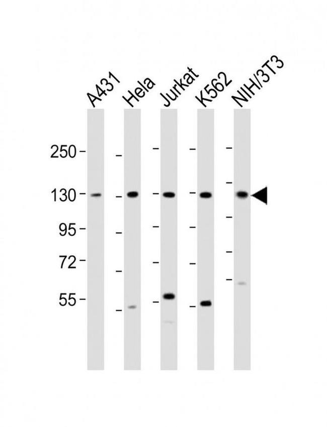 DDX42 Antibody in Western Blot (WB)