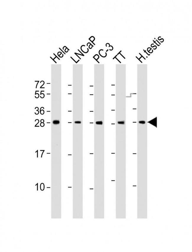 SSX1 Antibody in Western Blot (WB)