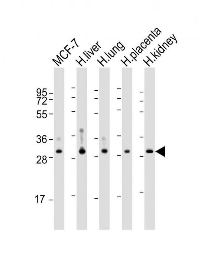 WBP1 Antibody in Western Blot (WB)