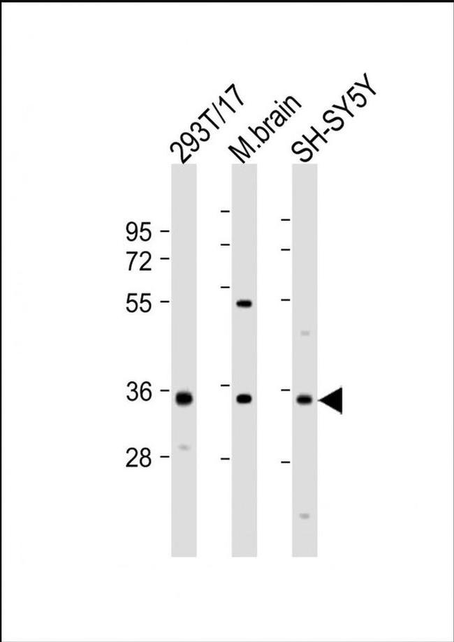 NAT8L Antibody in Western Blot (WB)