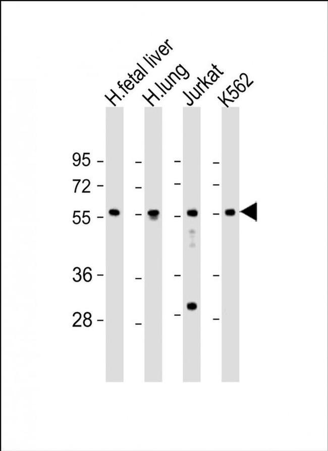 EFS Antibody in Western Blot (WB)