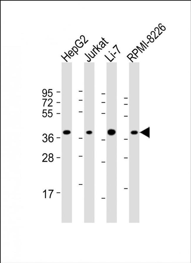 ARHGEF39 Antibody in Western Blot (WB)