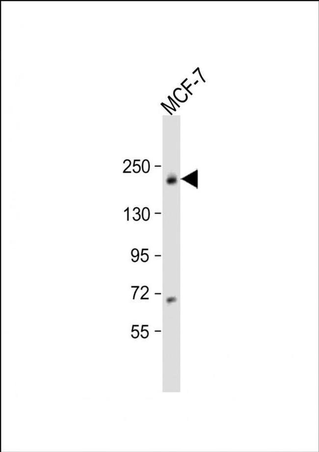 USP32 Antibody in Western Blot (WB)
