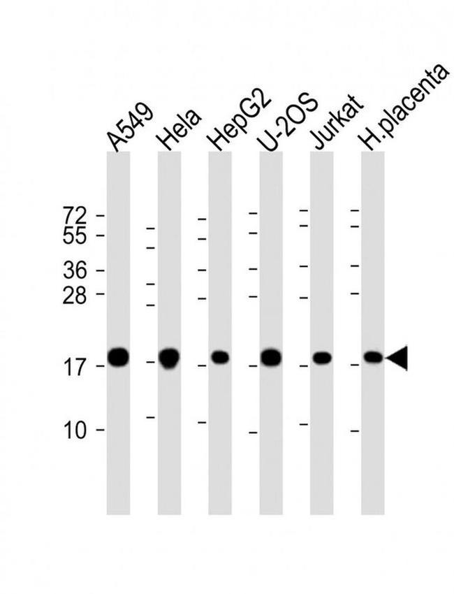 COMMD1 Antibody in Western Blot (WB)