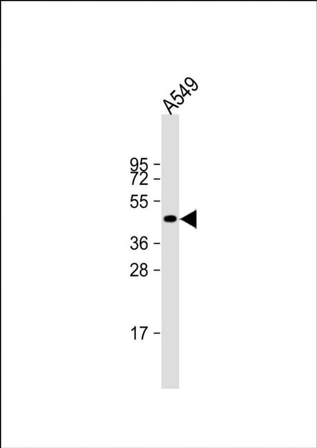 NAT16 Antibody in Western Blot (WB)