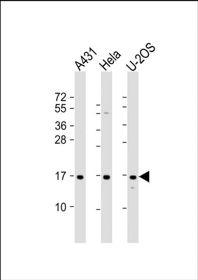 RPLP1 Antibody in Western Blot (WB)