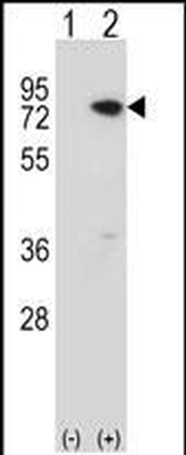 MECP2 Antibody in Western Blot (WB)
