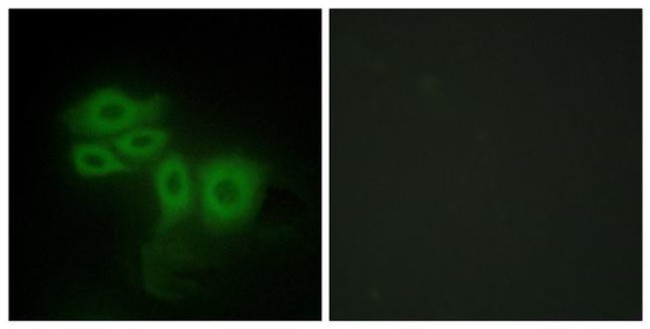 SLK Antibody in Immunocytochemistry (ICC/IF)