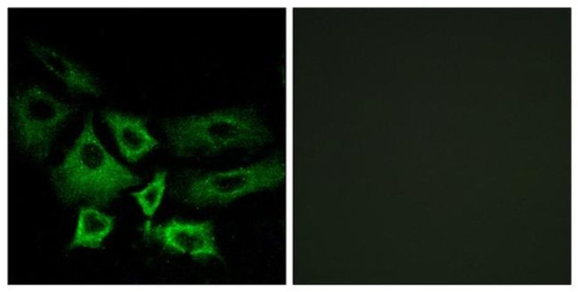NT5C1A Antibody in Immunocytochemistry (ICC/IF)