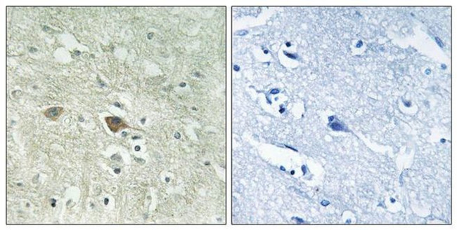 NDUFV3 Antibody in Immunohistochemistry (Paraffin) (IHC (P))
