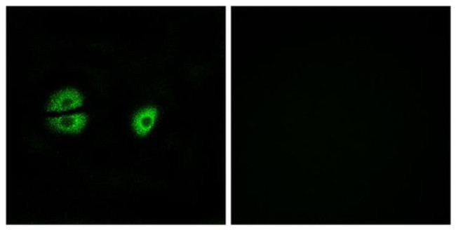 MRPS22 Antibody in Immunocytochemistry (ICC/IF)