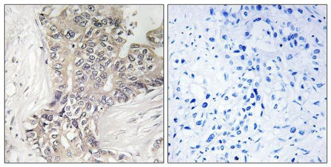 B3GALTL Antibody in Immunohistochemistry (Paraffin) (IHC (P))