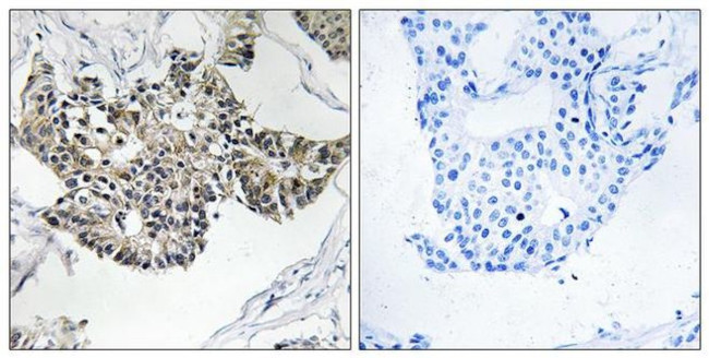 RSAD1 Antibody in Immunohistochemistry (Paraffin) (IHC (P))