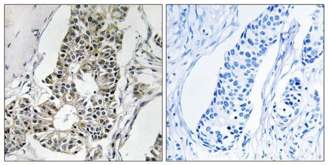 RIM4 Antibody in Immunohistochemistry (Paraffin) (IHC (P))