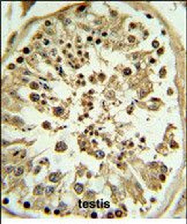Apolipoprotein L4 Antibody in Immunohistochemistry (Paraffin) (IHC (P))