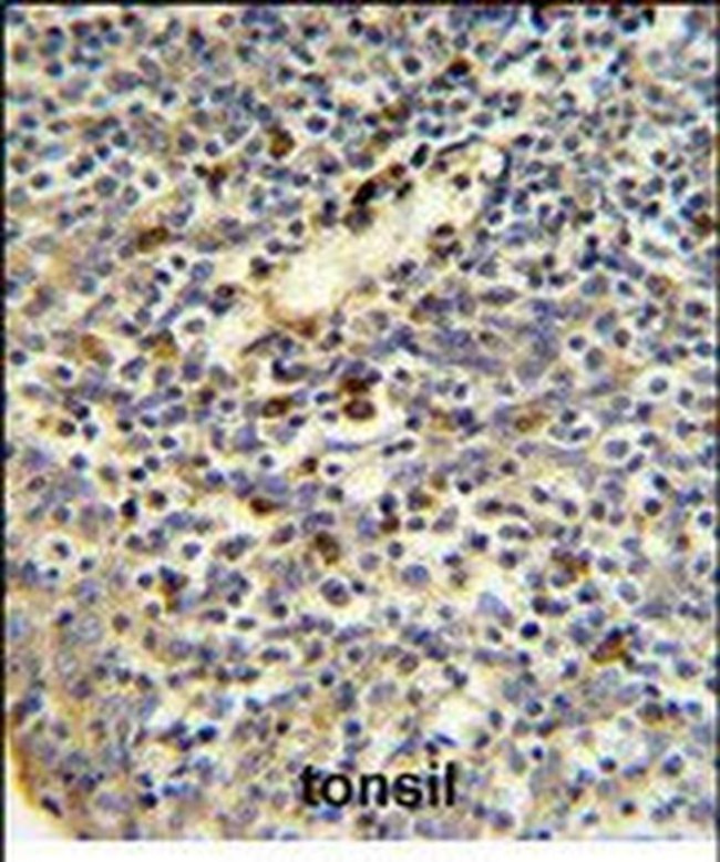 FKBP11 Antibody in Immunohistochemistry (Paraffin) (IHC (P))