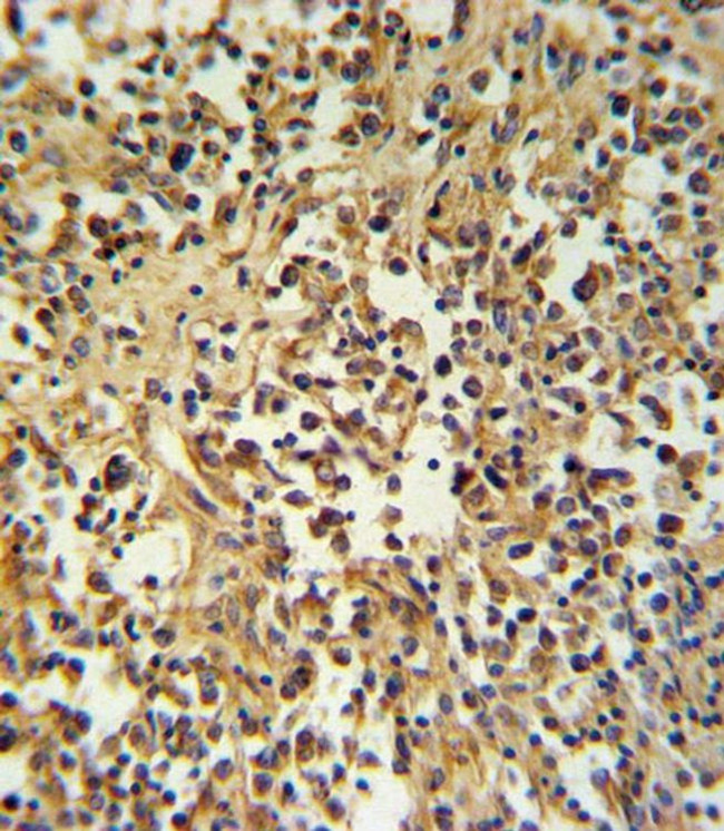 Granzyme M Antibody in Immunohistochemistry (Paraffin) (IHC (P))