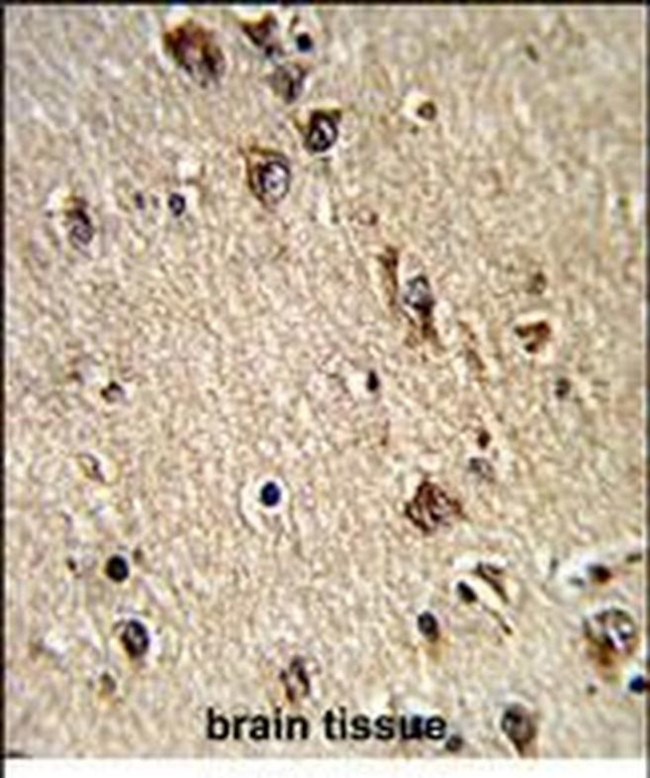 ALAD Antibody in Immunohistochemistry (Paraffin) (IHC (P))