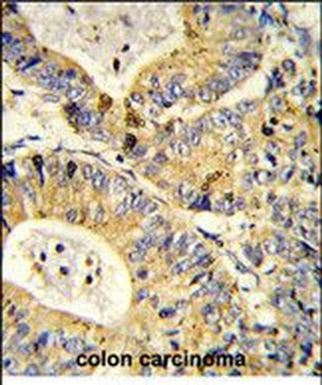 RPS18 Antibody in Immunohistochemistry (Paraffin) (IHC (P))
