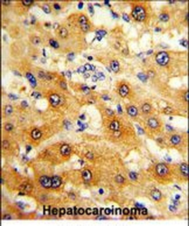 RPS15 Antibody in Immunohistochemistry (Paraffin) (IHC (P))