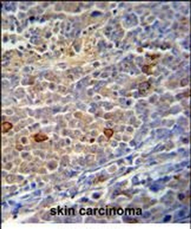 C9orf156 Antibody in Immunohistochemistry (Paraffin) (IHC (P))