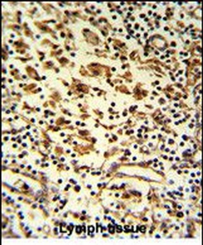 HMHA1 Antibody in Immunohistochemistry (Paraffin) (IHC (P))