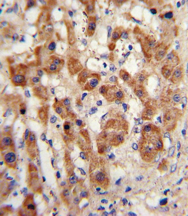 NAT2 Antibody in Immunohistochemistry (Paraffin) (IHC (P))