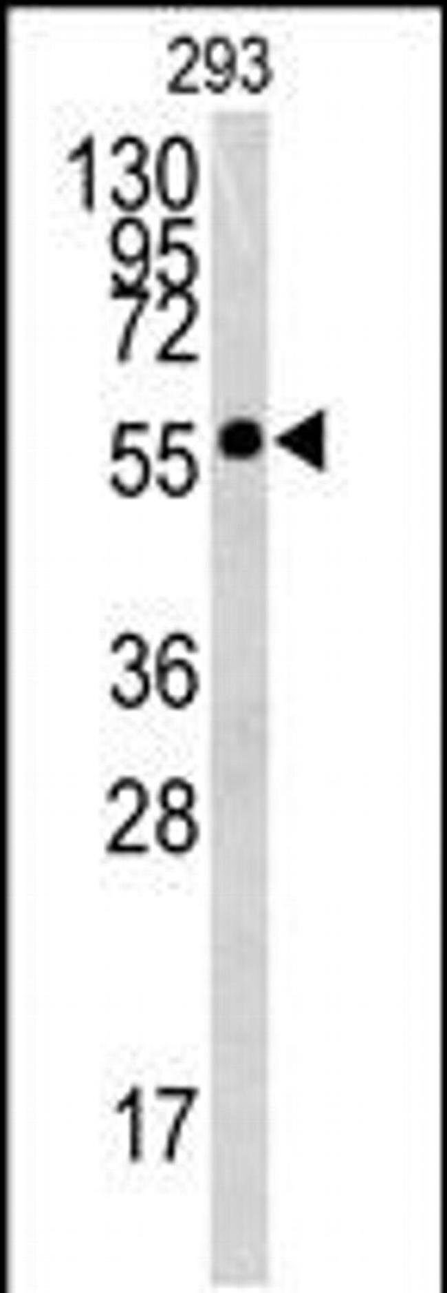 BTBD1 Antibody in Western Blot (WB)