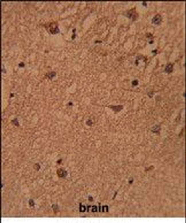 BABAM1 Antibody in Immunohistochemistry (Paraffin) (IHC (P))