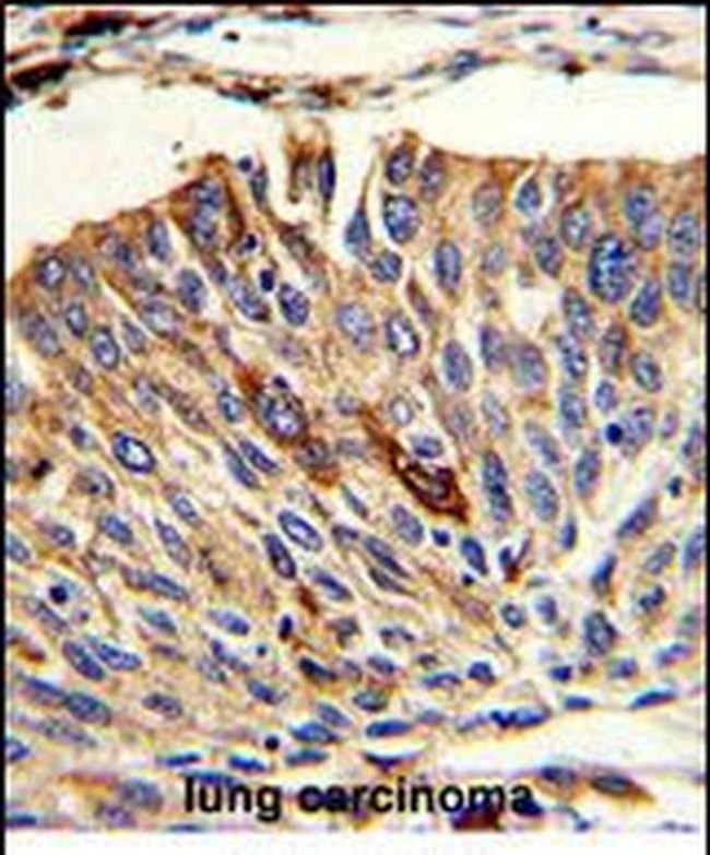 VTI1A Antibody in Immunohistochemistry (Paraffin) (IHC (P))