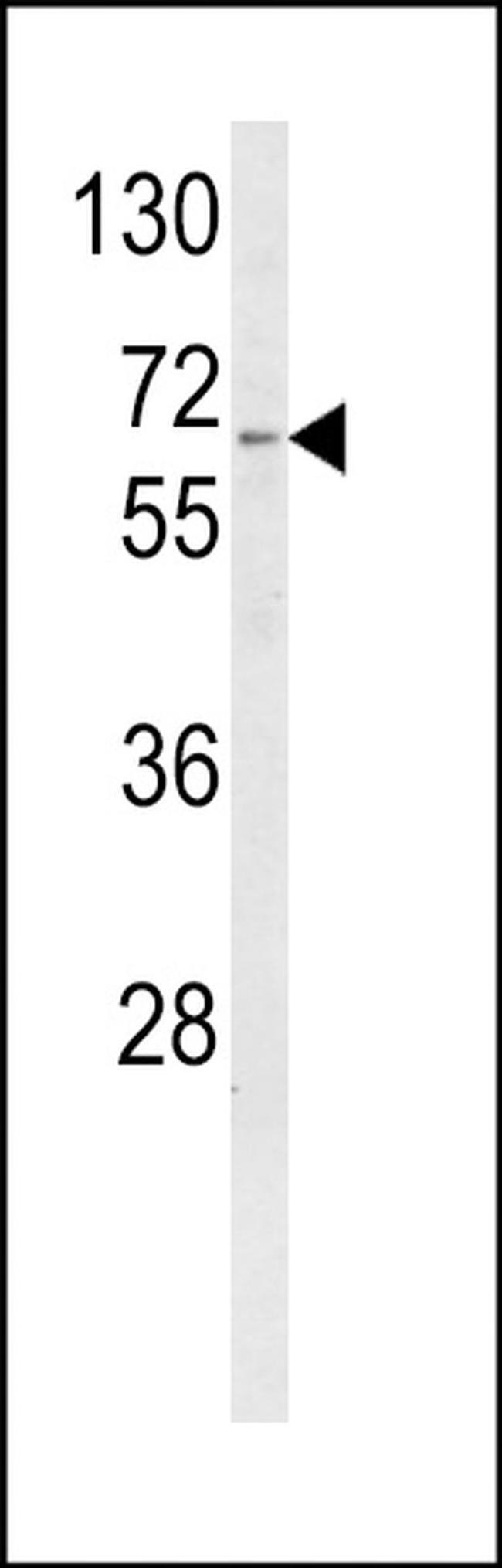 CYP4F3 Antibody in Western Blot (WB)