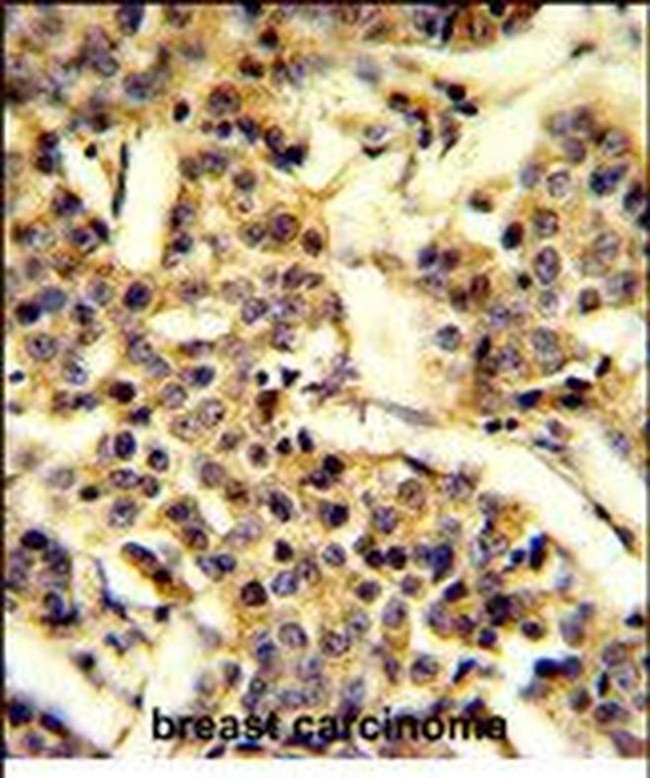 CYP2A13 Antibody in Immunohistochemistry (Paraffin) (IHC (P))