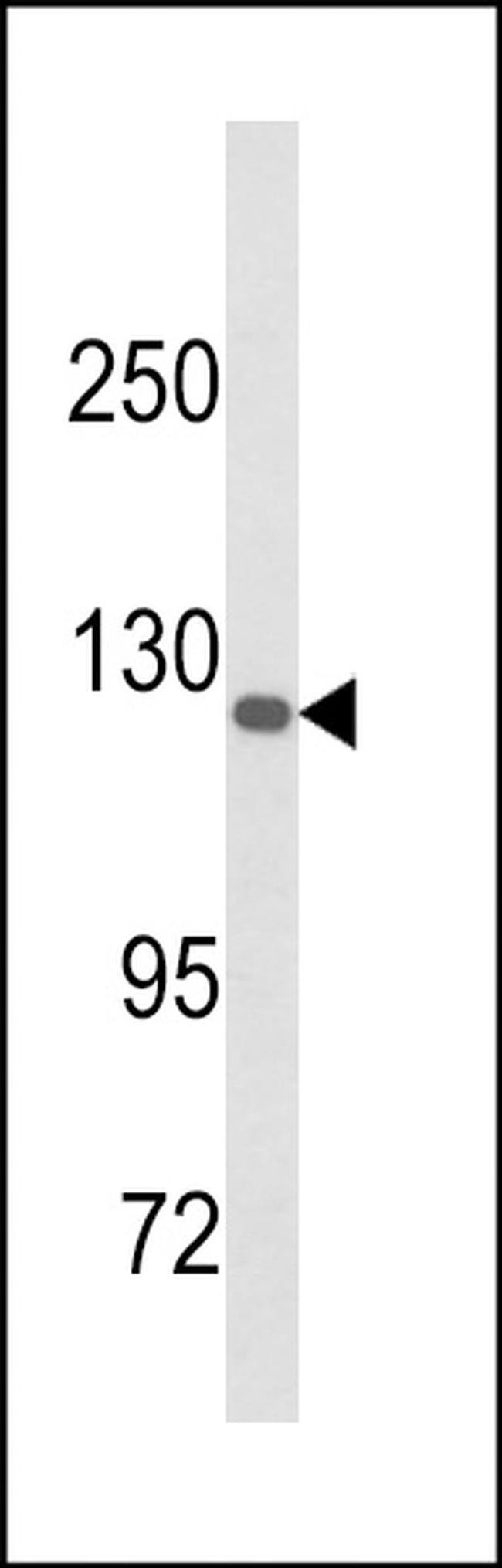 DSC1 Antibody in Western Blot (WB)
