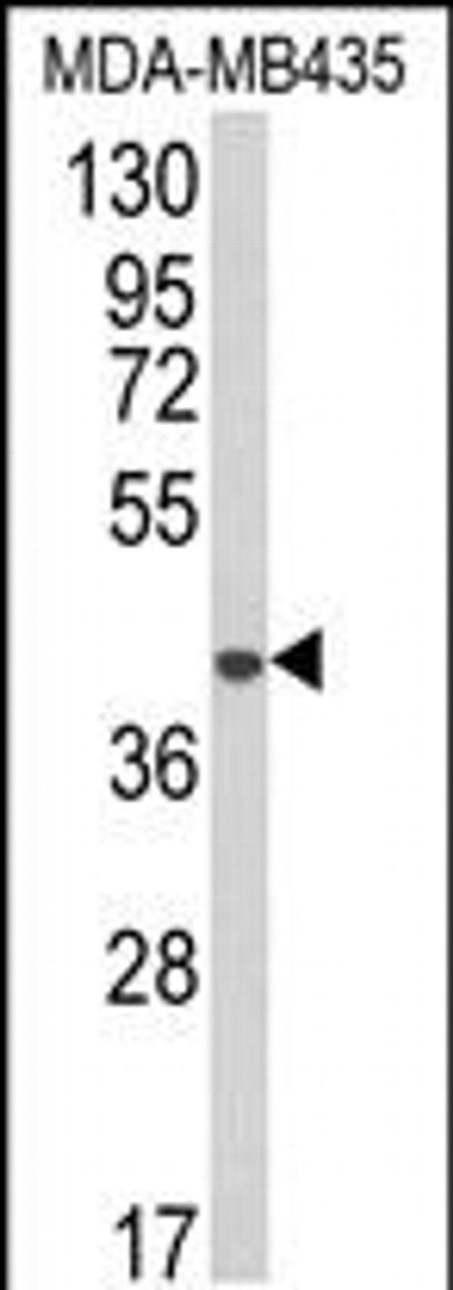 AGPAT4 Antibody in Western Blot (WB)