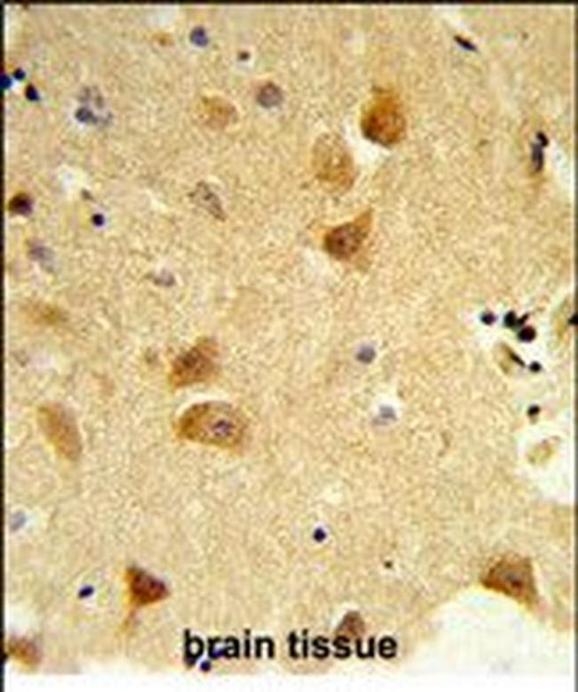 DERL1 Antibody in Immunohistochemistry (Paraffin) (IHC (P))