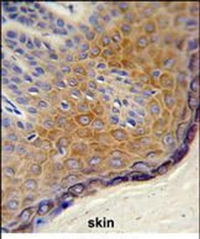 DERA Antibody in Immunohistochemistry (Paraffin) (IHC (P))