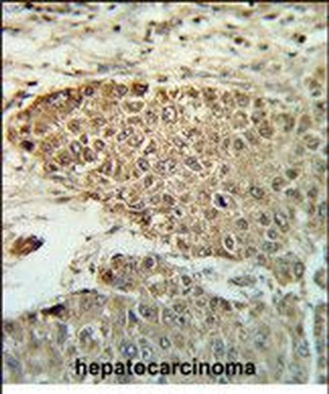 BIN3 Antibody in Immunohistochemistry (Paraffin) (IHC (P))