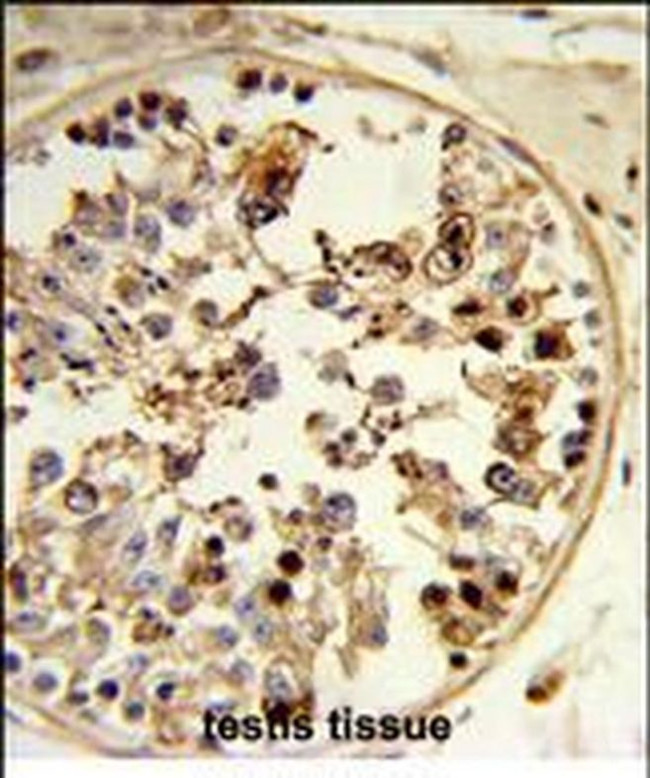 Tug Antibody in Immunohistochemistry (Paraffin) (IHC (P))