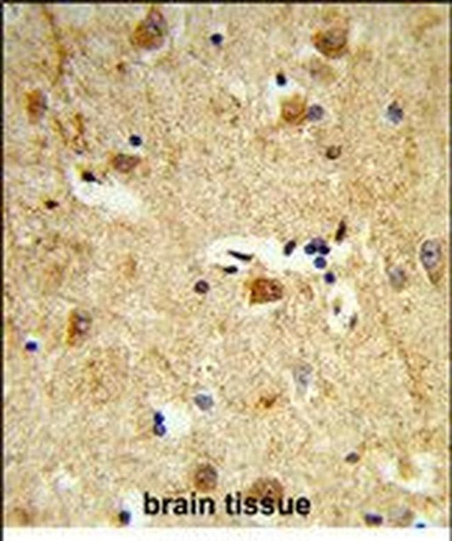 DOLK Antibody in Immunohistochemistry (Paraffin) (IHC (P))