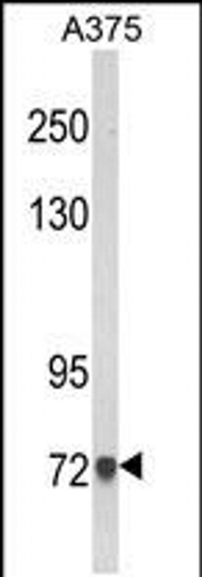 AMOTL2 Antibody in Western Blot (WB)