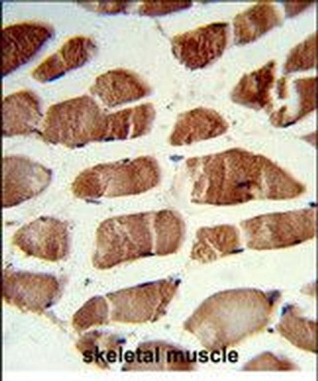 CSRP2BP Antibody in Immunohistochemistry (Paraffin) (IHC (P))