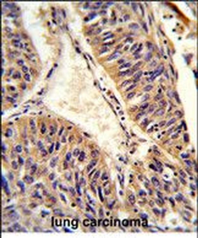 ALG14 Antibody in Immunohistochemistry (Paraffin) (IHC (P))