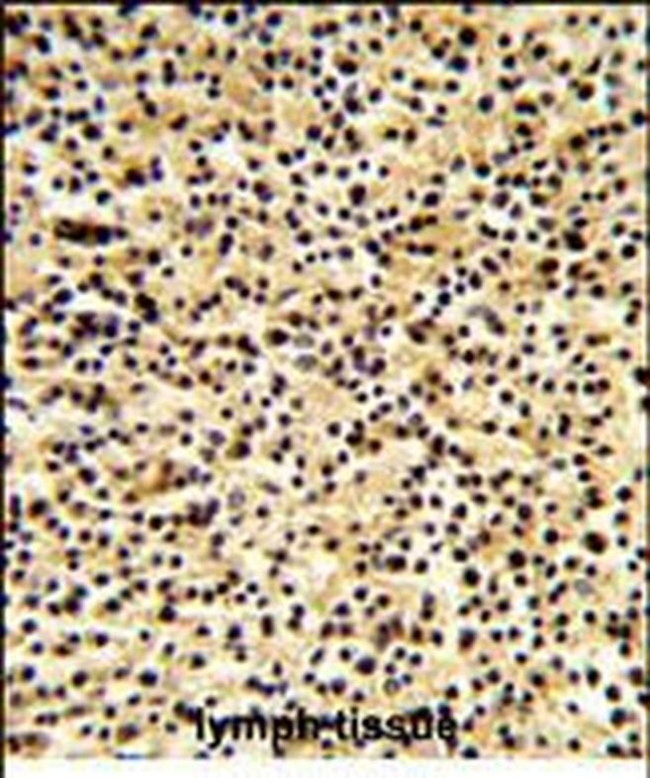 DTX1 Antibody in Immunohistochemistry (Paraffin) (IHC (P))