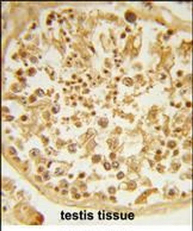 DZIP1 Antibody in Immunohistochemistry (Paraffin) (IHC (P))