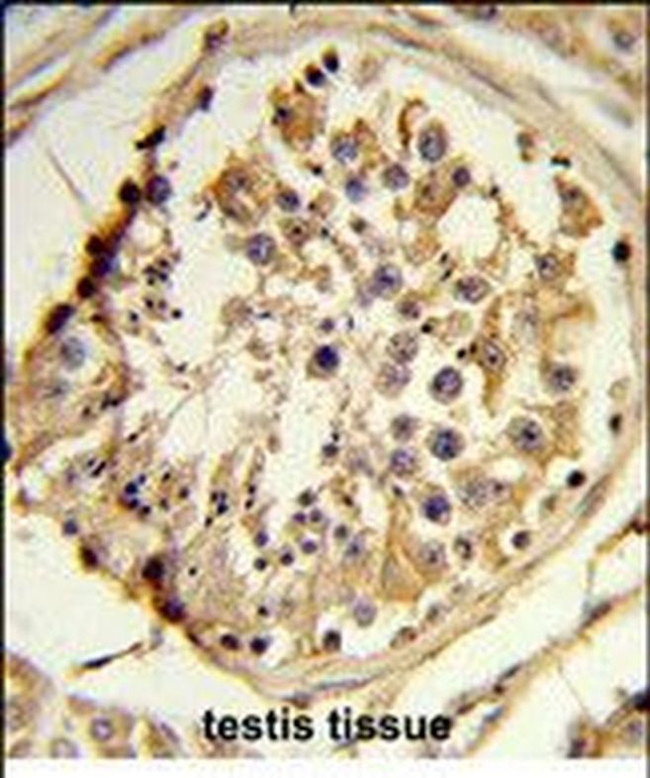 C14orf145 Antibody in Immunohistochemistry (Paraffin) (IHC (P))
