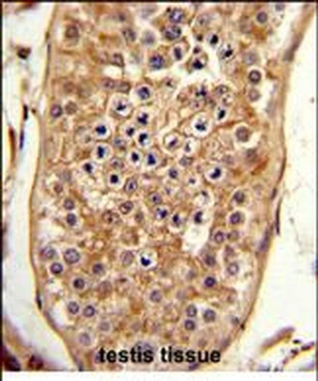 C15orf2 Antibody in Immunohistochemistry (Paraffin) (IHC (P))