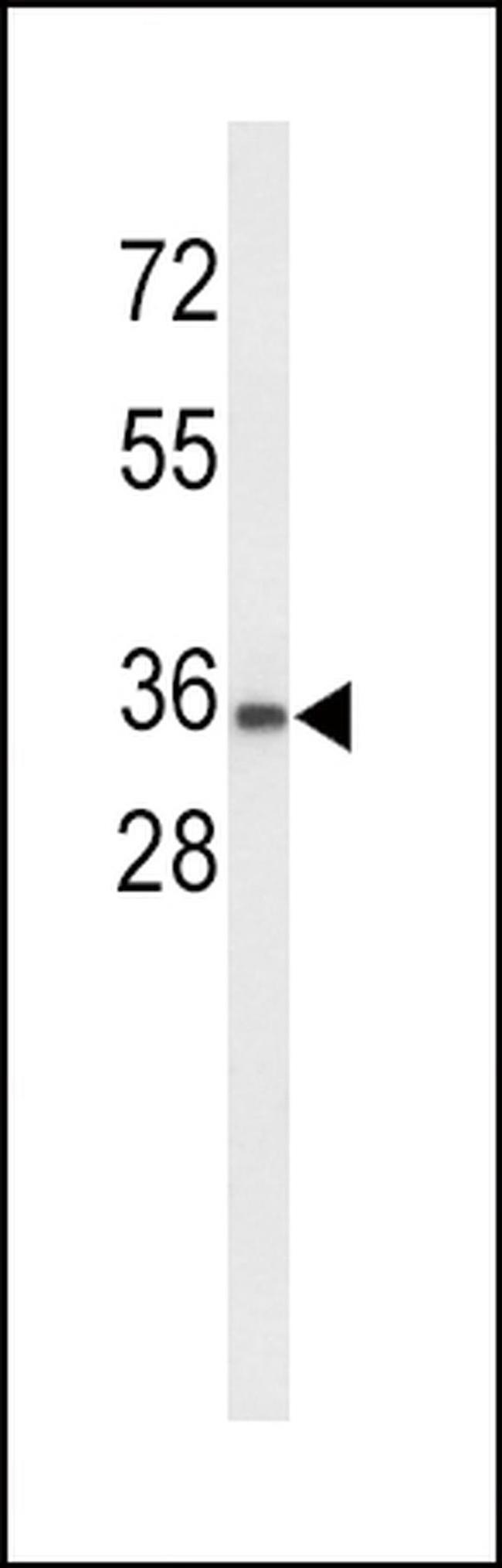 UPK1A Antibody in Western Blot (WB)
