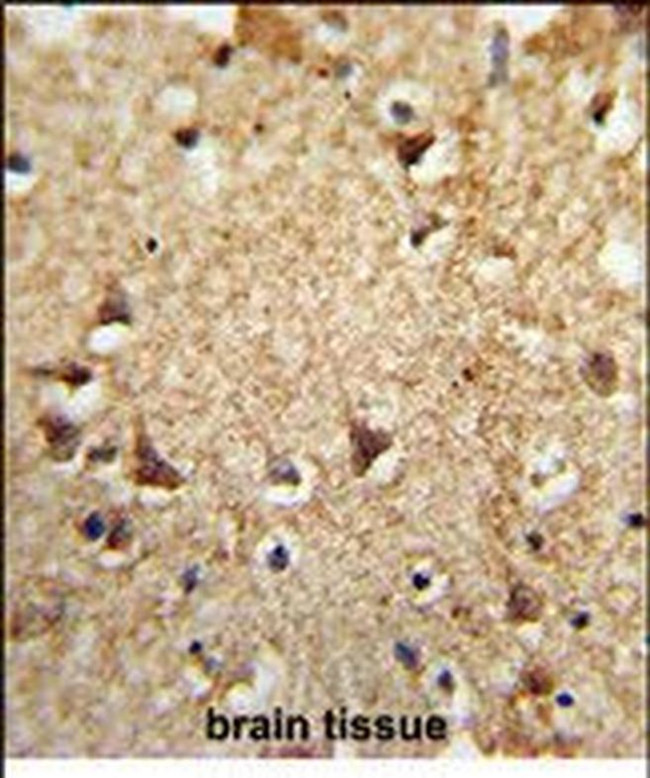 EIF2A Antibody in Immunohistochemistry (Paraffin) (IHC (P))