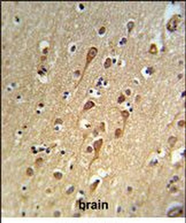 URG4 Antibody in Immunohistochemistry (Paraffin) (IHC (P))