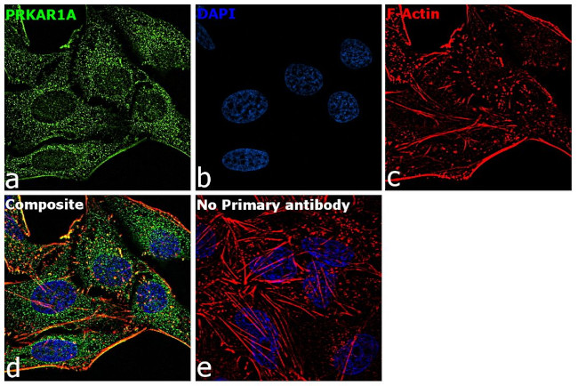 PRKAR1A Antibody in Immunocytochemistry (ICC/IF)